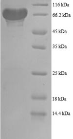 Recombinant Human 6-phosphogluconate dehydrogenase, decarboxylating (PGD), partial – Figure 1 of 1