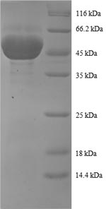(Tris-Glycine gel) Discontinuous SDS-PAGE (reduced) with 5% enrichment gel and 15% separation gel.
