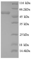 Recombinant Human Death domain-associated protein 6 (DAXX), partial – Figure 1 of 1