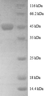 Recombinant Human ADP-ribosylation factor-like protein 2 (ARL2), partial – Figure 1 of 1