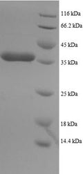 Recombinant Human Dynein light chain 1, Cytoplasmic domain (DYNLL1) – Figure 1 of 1