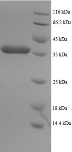 Recombinant Human Dynein light chain 1, Cytoplasmic domain (DYNLL1) – Figure 1 of 1