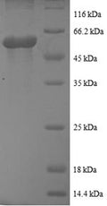 Recombinant Human Casein kinase I isoform epsilon (CSNK1E), partial – Figure 1 of 1