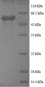 Recombinant Human Casein kinase I isoform epsilon (CSNK1E), partial – Figure 1 of 1
