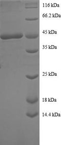 Recombinant Human Sorting nexin-3 (SNX3) – Figure 1 of 1
