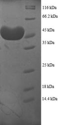 Recombinant Human Proteasome subunit alpha type-7 (PSMA7), partial – Figure 1 of 1