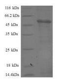 Recombinant Human Proteasome subunit beta type-7 (PSMB7), partial – Figure 1 of 1