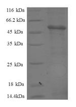 Recombinant Human Proteasome subunit beta type-7 (PSMB7), partial – Figure 1 of 1