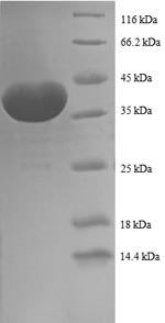 Recombinant Human Prefoldin subunit 1 (PFDN1) – Figure 1 of 1
