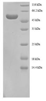 Recombinant Human 14-3-3 protein beta/alpha (YWHAB) – Figure 1 of 1