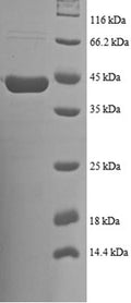 Recombinant Human NADH dehydrogenase [ubiquinone] 1 beta subcomplex subunit 7 (NDUFB7) – Figure 1 of 1