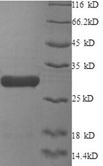 Recombinant Human X-ray repair cross-complementing protein 6 (XRCC6), partial – Figure 1 of 1