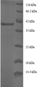 Recombinant Human Alpha-endosulfine (ENSA) – Figure 1 of 1