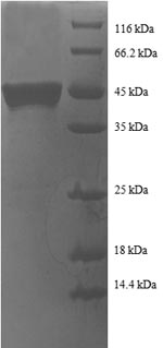 Recombinant Human Transcription factor BTF3 (BTF3), partial – Figure 1 of 1