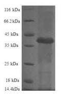 Recombinant Human 60S ribosomal protein L36a-like (RPL36AL) – Figure 1 of 1