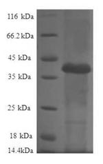 Recombinant Human 60S ribosomal protein L36a-like (RPL36AL) – Figure 1 of 1