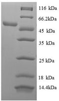 Recombinant Human 60S ribosomal protein L18 (RPL18), partial – Figure 1 of 1