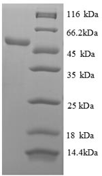 Recombinant Human 60S ribosomal protein L18 (RPL18), partial – Figure 1 of 1