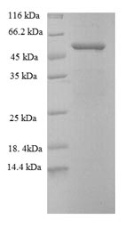 Recombinant Human Disintegrin and metalloproteinase domain-containing protein 15 (ADAM15), partial – Figure 1 of 1