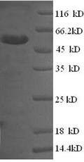 Recombinant Human Membrane-associated phosphatidylinositol transfer protein 1 (PITPNM1), partial – Figure 1 of 1