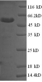 Recombinant Human Membrane-associated phosphatidylinositol transfer protein 1 (PITPNM1), partial – Figure 1 of 1