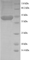Recombinant Human Rhombotin-1 (LMO1), partial – Figure 1 of 1