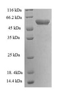 Recombinant Human 14-3-3 protein eta (YWHAH), partial – Figure 1 of 1