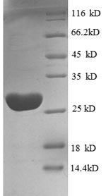 Recombinant Human Elongation factor Tu, mitochondrial (TUFM), partial – Figure 1 of 1
