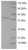 Recombinant Human 60S acidic ribosomal protein P2 (RPLP2), partial – Figure 1 of 1