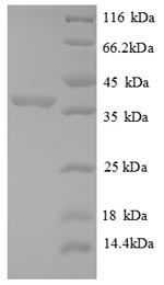 Recombinant Human 60S acidic ribosomal protein P2 (RPLP2), partial – Figure 1 of 1