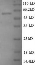 Recombinant Human Large ribosomal subunit protein uL3 (RPL3), partial – Figure 1 of 1