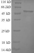 Recombinant Human 60S ribosomal protein L15 (RPL15) – Figure 1 of 1
