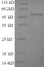 Recombinant Human 60S ribosomal protein L15 (RPL15) – Figure 1 of 1