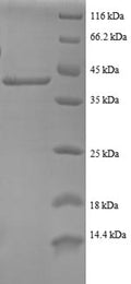 Recombinant Human 40S ribosomal protein S24 (RPS24), partial – Figure 1 of 1