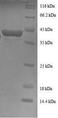Recombinant Human 40S ribosomal protein S16 (RPS16), partial – Figure 1 of 1