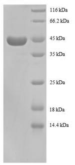 Recombinant Human 40S ribosomal protein S13 (RPS13), partial – Figure 1 of 1