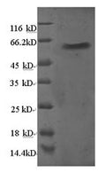 Recombinant Human 60S ribosomal protein L5 (RPL5) – Figure 1 of 1