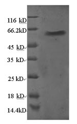 Recombinant Human 60S ribosomal protein L5 (RPL5) – Figure 1 of 1