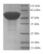 Recombinant Human 60S ribosomal protein L17 (RPL17) – Figure 1 of 1