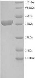 Recombinant Human 40S ribosomal protein S12 (RPS12) – Figure 1 of 1