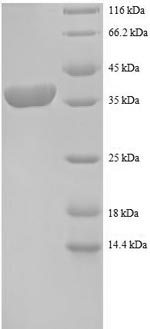 Recombinant Human 40S ribosomal protein S12 (RPS12) – Figure 1 of 1