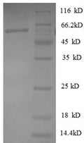 Recombinant Human Heterogeneous nuclear ribonucleoprotein D0 (HNRNPD), partial – Figure 1 of 1
