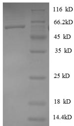 Recombinant Human Heterogeneous nuclear ribonucleoprotein D0 (HNRNPD), partial – Figure 1 of 1