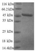 Recombinant Human 40S ribosomal protein S10 (RPS10), partial – Figure 1 of 1