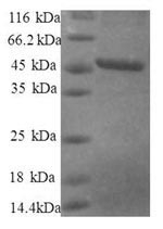 Recombinant Human 40S ribosomal protein S10 (RPS10), partial – Figure 1 of 1