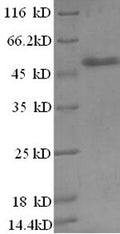 Recombinant Human Zinc finger BED domain-containing protein 1 (ZBED1), partial – Figure 1 of 1