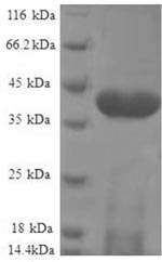 Recombinant Human NADH dehydrogenase [ubiquinone] iron-sulfur protein 5 (NDUFS5) – Figure 1 of 1