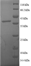 (Tris-Glycine gel) Discontinuous SDS-PAGE (reduced) with 5% enrichment gel and 15% separation gel.