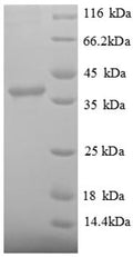 Recombinant Human Signal recognition particle 14 kDa protein (SRP14), partial – Figure 1 of 1