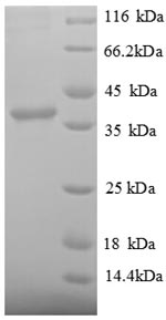Recombinant Human Signal recognition particle 14 kDa protein (SRP14), partial – Figure 1 of 1